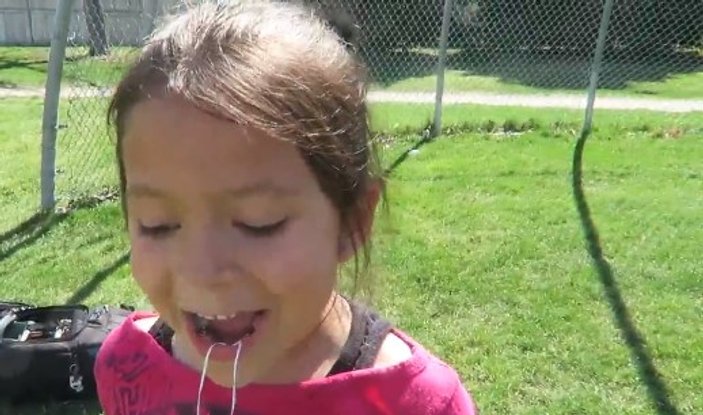 Kızının dişini drone ile çekti İZLE