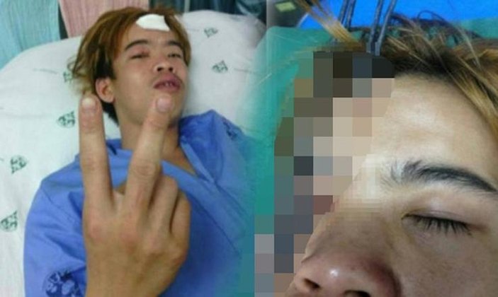 Taylandlı genç zıpkınla kendini gözünden vurdu