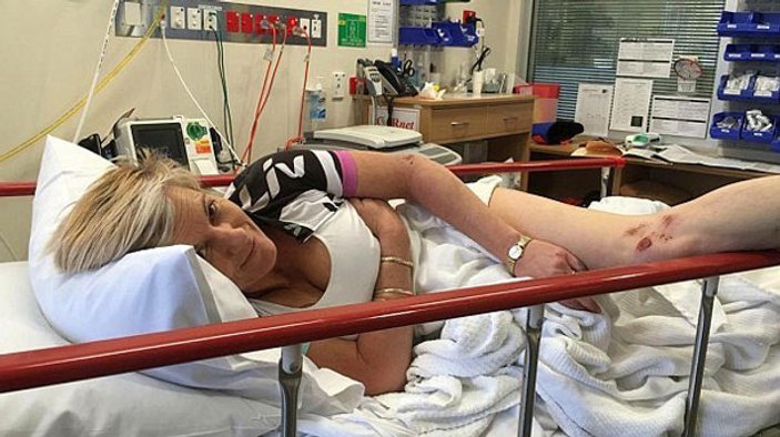 Kanguru saldırısına uğrayan kadının silikonları patladı