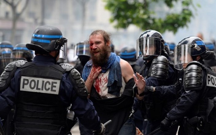 Fransız polisin attığı gaz kapsülü gözüne isabet etti