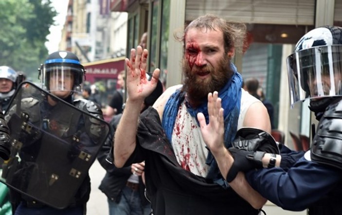 Fransız polisin attığı gaz kapsülü gözüne isabet etti