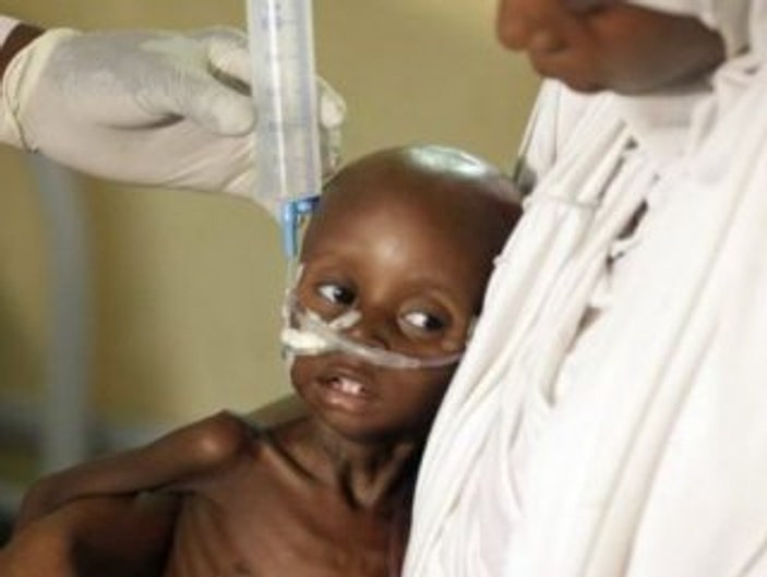 Nijerya'da çocuklar açlıktan ölüyor