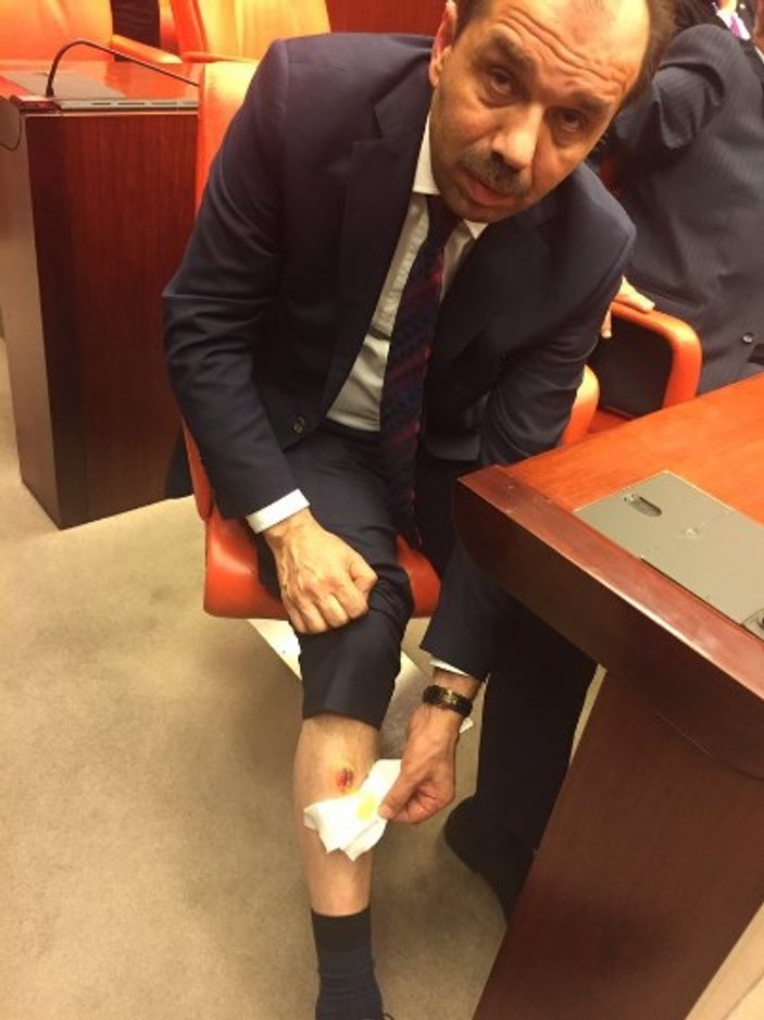 Eren Erdem AK Partili vekili bacağından ısırdı