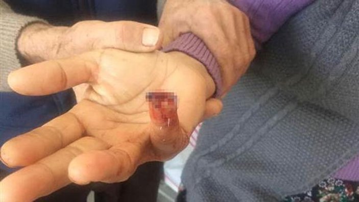 Antalya'da 'komşum ısırıp kopardığı parmağımı yuttu' iddiası