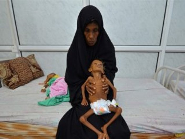 Birleşmiş Milletler: Yemen'de açlık tehlikesi artıyor