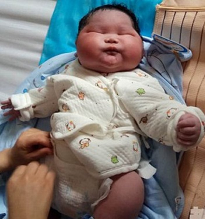 Çin'de 6 kilo doğan bebek görenleri şaşırttı