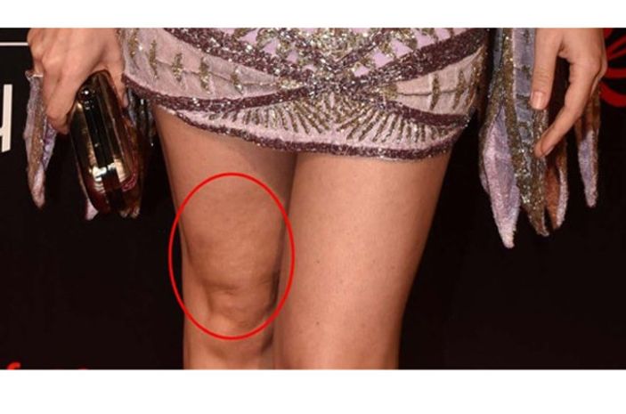 Fahriye Evcen'in selülitleri gözüktü