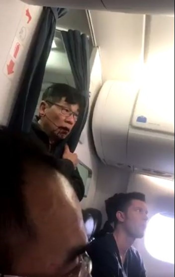 United Airlines yolcusu darp edildi