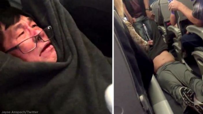 United Airlines yolcusu darp edildi