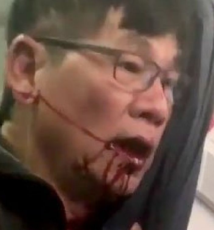 United Airlines yolcusu darp edildi