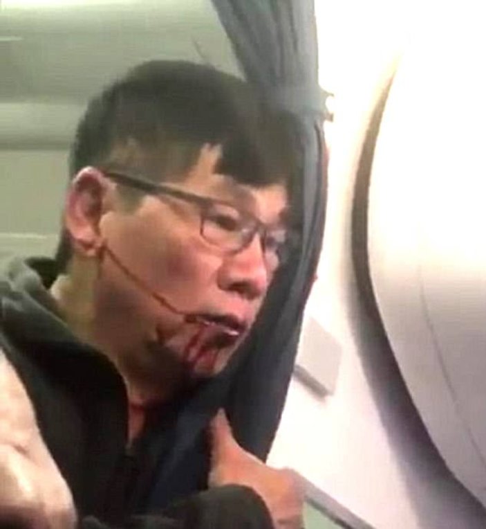 United Airlines yolcusunu akrep ısırdı