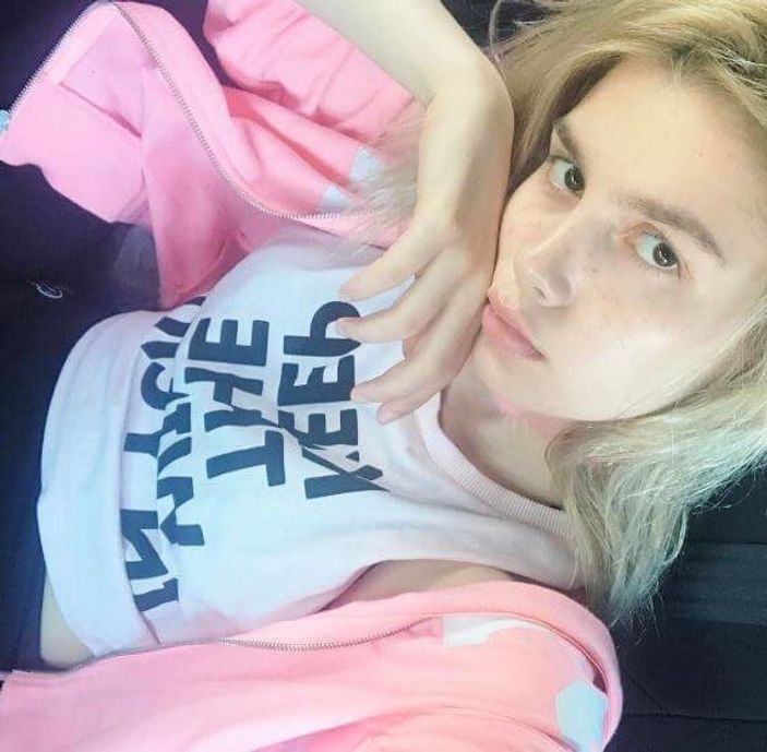 Aleyna Tilki estetik yaptırdı