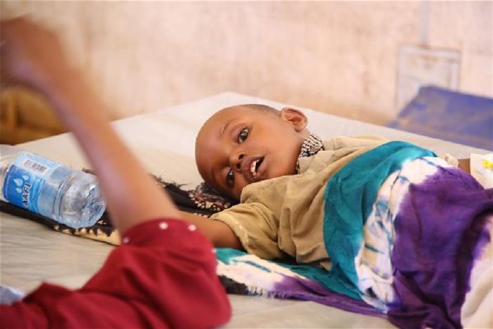 Somali’de 1.4 milyon çocuk aç