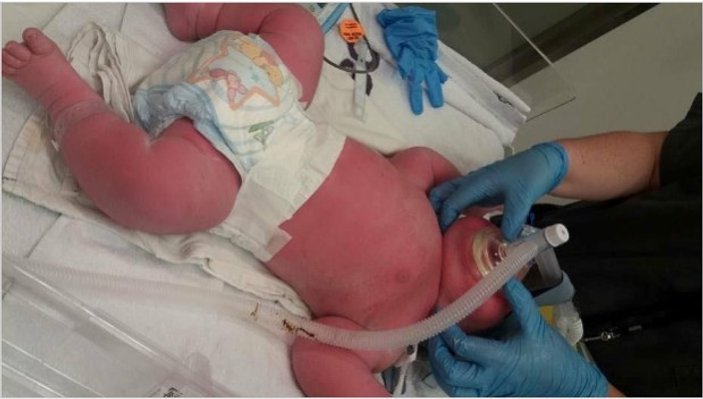 Yeni Zelanda'da 7 kiloluk bebek doğdu