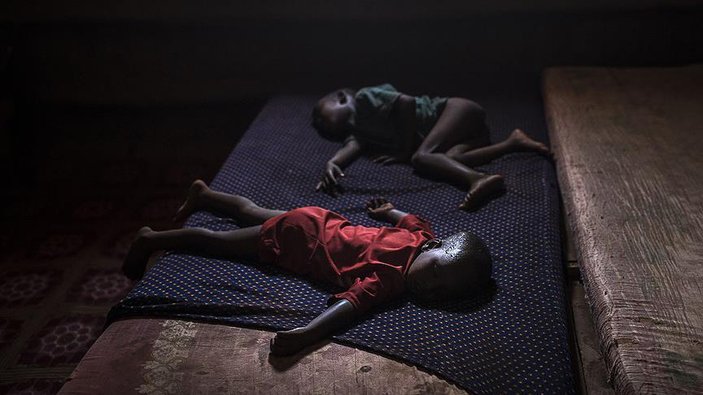 Somali'de kolera 700 kişinin ölümüne neden oldu