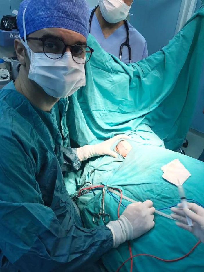 30 günlük bebek beyin ameliyatı geçirdi