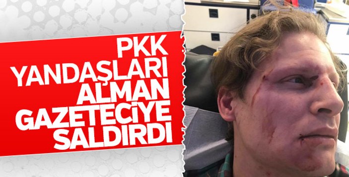 PKK'lıların saldırdığı Alman gazeteciden Erdoğan'a teşekkür