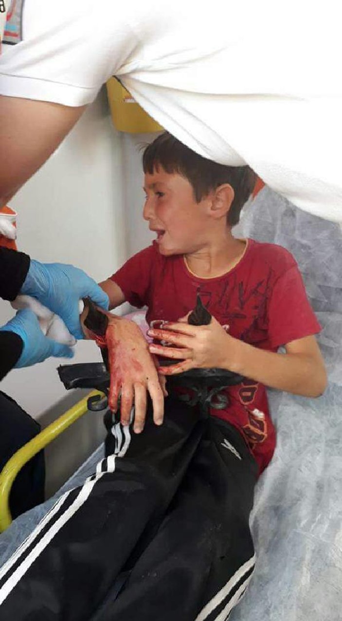Korkuluklardan atlayan çocuğun koluna demir saplandı