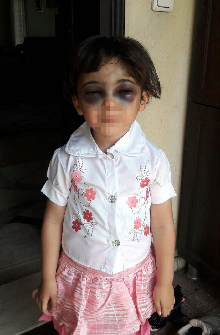 3 yaşındaki kızını döven üvey anne tutuklandı