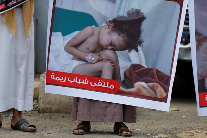 Yemen'de 380 bin çocuk açlıktan ölümle yüz yüze