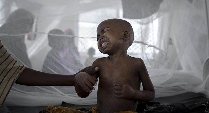 Nijerya'da kolera ile mücadele