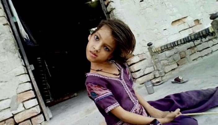 9 yaşındaki Pakistanlı kız başını 180 derece çeviriyor