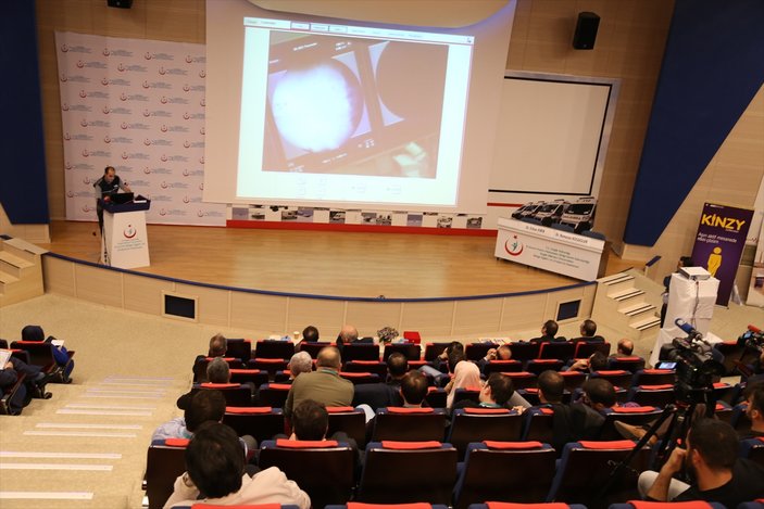 Erzurum'da canlı yayında böbrek taşı kırma ameliyatı yapıldı