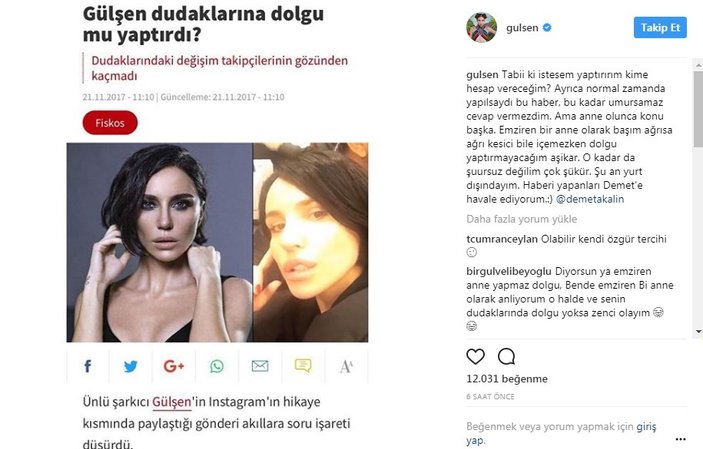 Gülşen dolgu haberlerine sitem etti