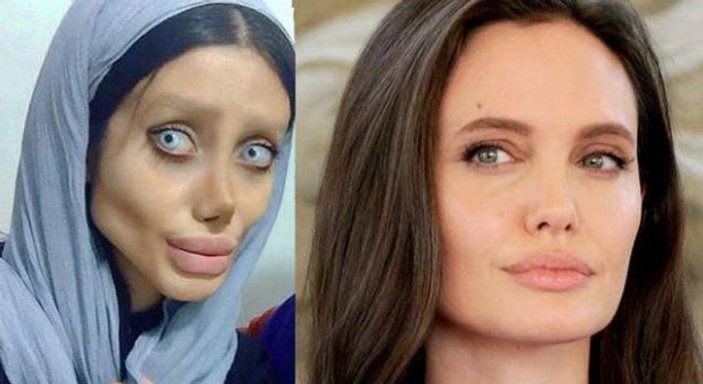 İranlı kadın, Jolie'ye benzemek isterken çirkinleşti