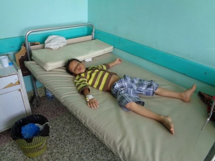 Difteri Yemen'de 46 kişinin hayatına son verdi