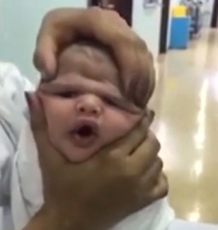 Hemşireler bebeğin suratıyla dalga geçti