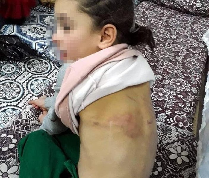 Suriyeli baba kızına işkence yapıp dilendirdi