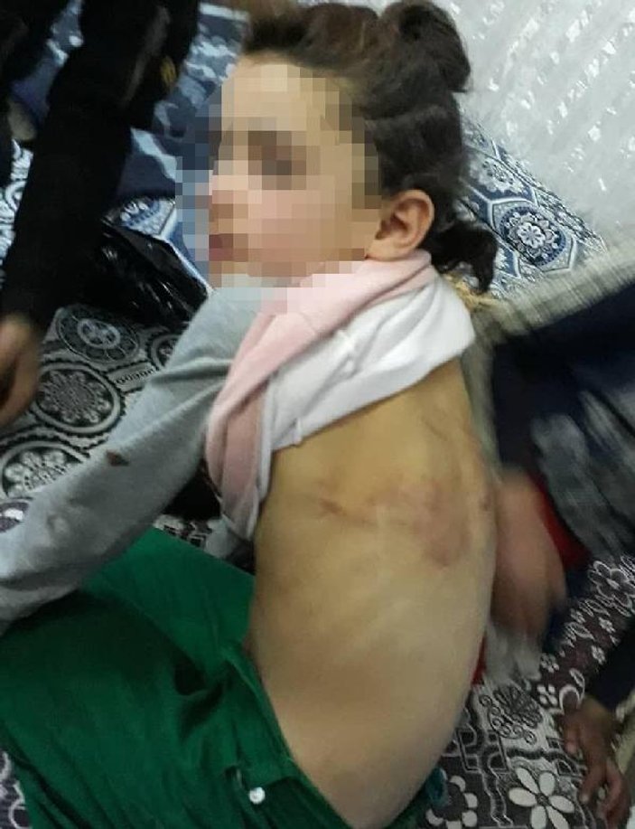 Kızına işkence yapıp dilendiren Suriyeli tutuklandı