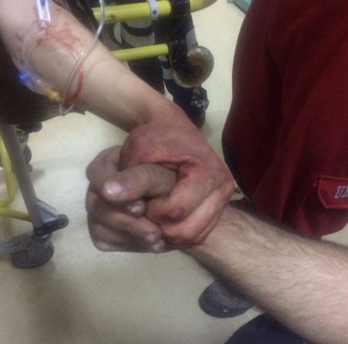 Afrin'de yaralanan askerlerin yüreklere dokunan fotoğrafı