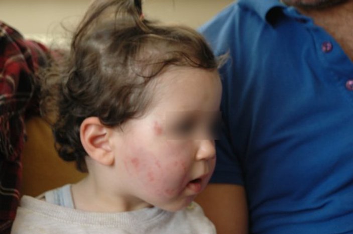 Kreşte 1,5 yaşındaki bebeğin dövüldüğü iddiası