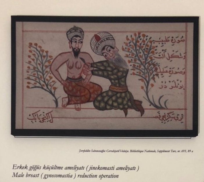 Osmanlı’da estetik ve göğüs küçültme