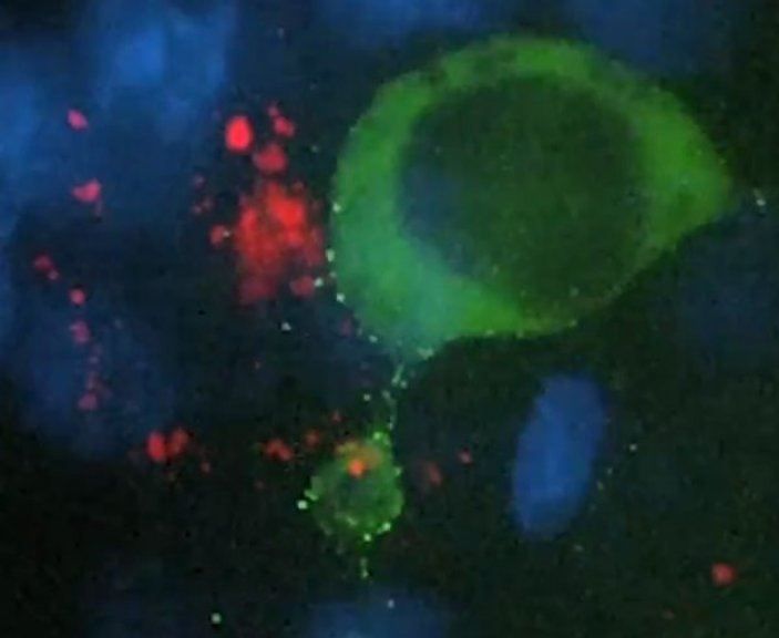 HIV'in hücrelere dağılışı ilk kez görüntülendi