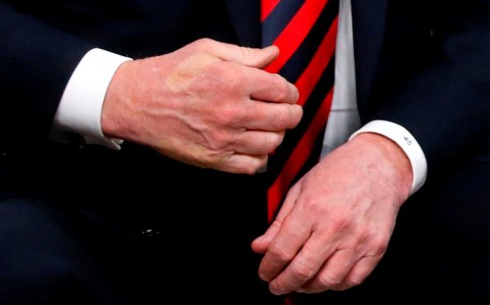 G7'deki gerilimin fotoğrafı: Trump'ın elindeki iz