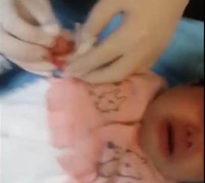 Hemşire makasla 1,5 aylık bebeğin parmağını kesti