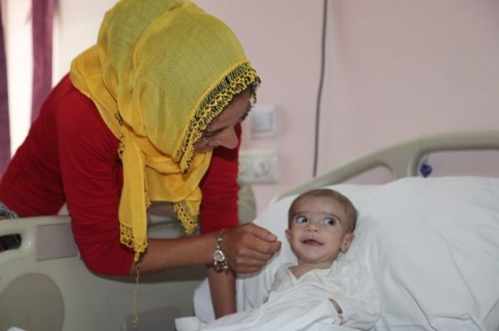 i 4 aylık bebeğin kalp damarları değiştirildi