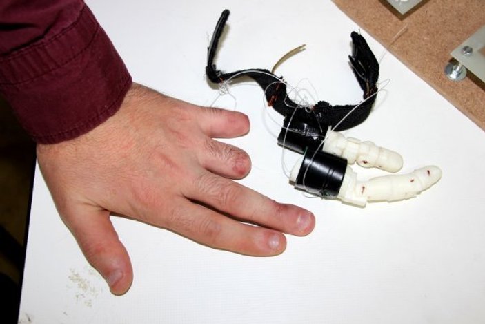 Mühendislik öğrencisi, kendine protez parmak yaptı