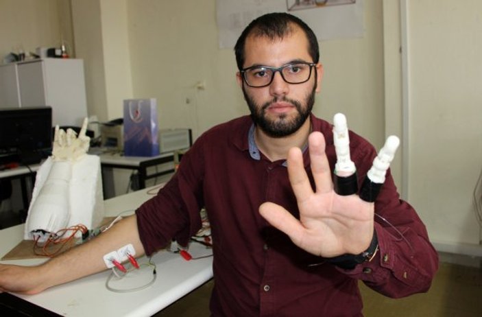 Mühendislik öğrencisi, kendine protez parmak yaptı