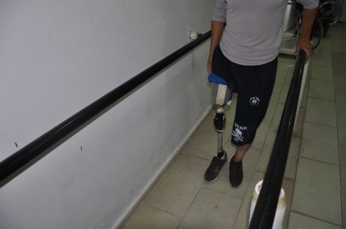 6 bin 500 Suriyeliye protez takıldı