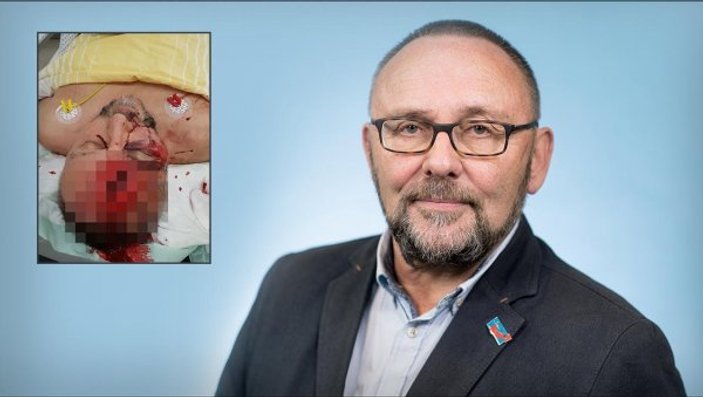 Almanya'da AfD milletvekili öldüresiye dövüldü