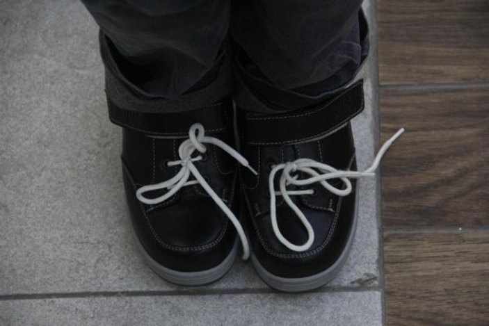 24 parmaklı çocuğa devletten özel ayakkabı