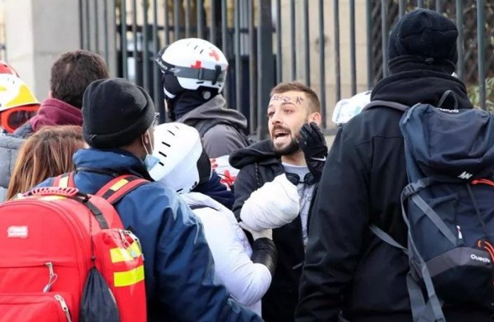 Fransız polisi eylemcinin elini kopardı