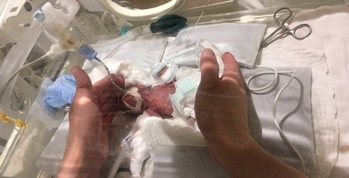 Japonya'da 268 gram doğan bebek taburcu edildi