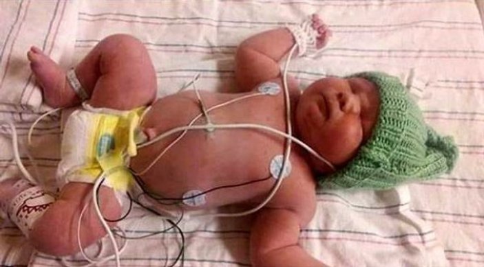 ABD'de bir kız bebeği 7 kilo doğdu