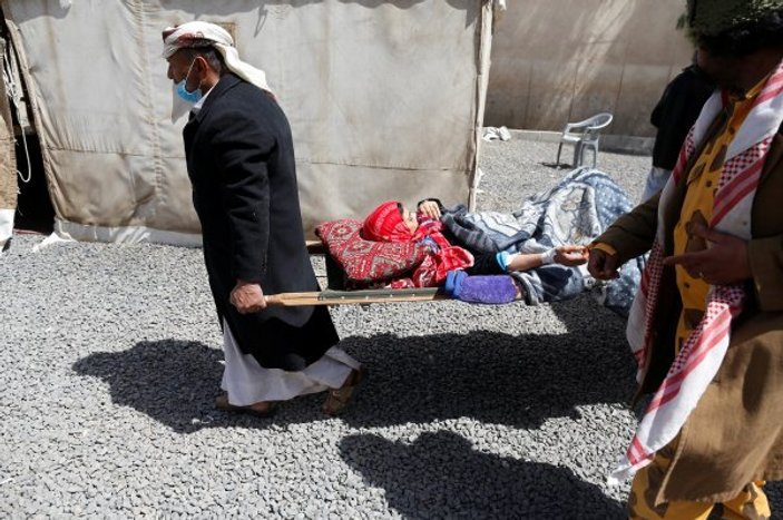 Yemen'de kolera salgını alarmı