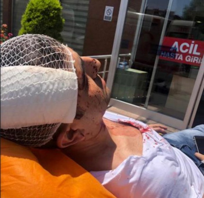 Gazeteci Murat Alan saldırıya uğradı